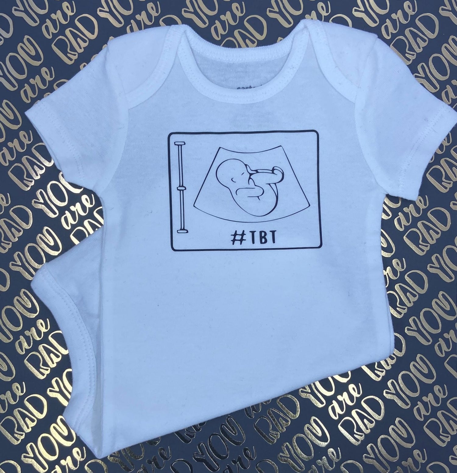 baby onesie with tbt hashtag and illustrated ultrasound image design